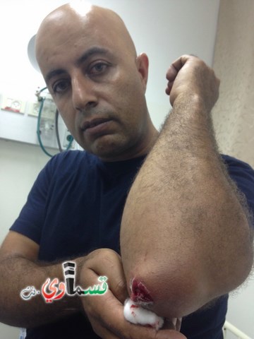 الناصرة: اشتباكات في منطقة العين والشرطة تعتقل 17 شابًا و 3 فتيات  واستهداف الصحافيين العرب 